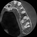 Teeth MPR image. Cone-beam tomographic scan. Feldkamp reconstruction
