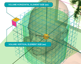 Reconstructed  volume element size (voxel size)